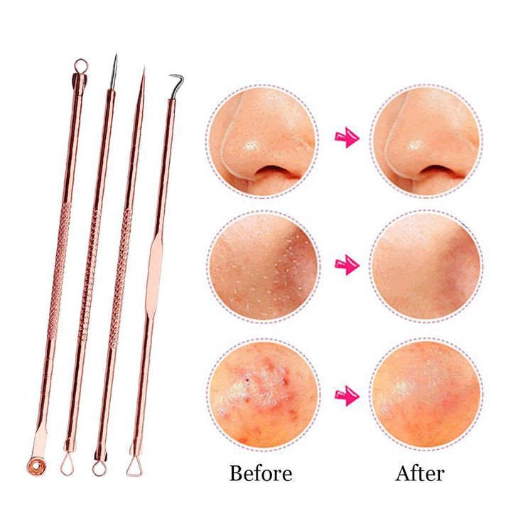 Acne removal accessories